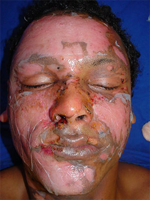 Membracel Application