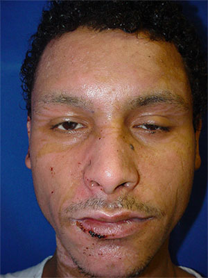 After 12 days of treatment