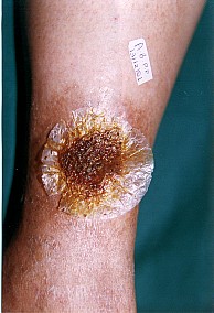 Porous Regenerative Membrane