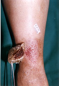 Porous Regenerative Membrane